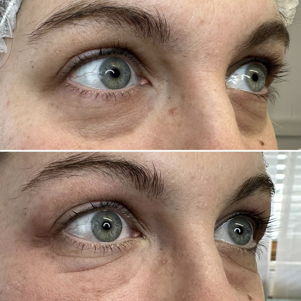 Augenringe Camouflage Pigmentierung in Wiener Neustadt – Vision Bodyart