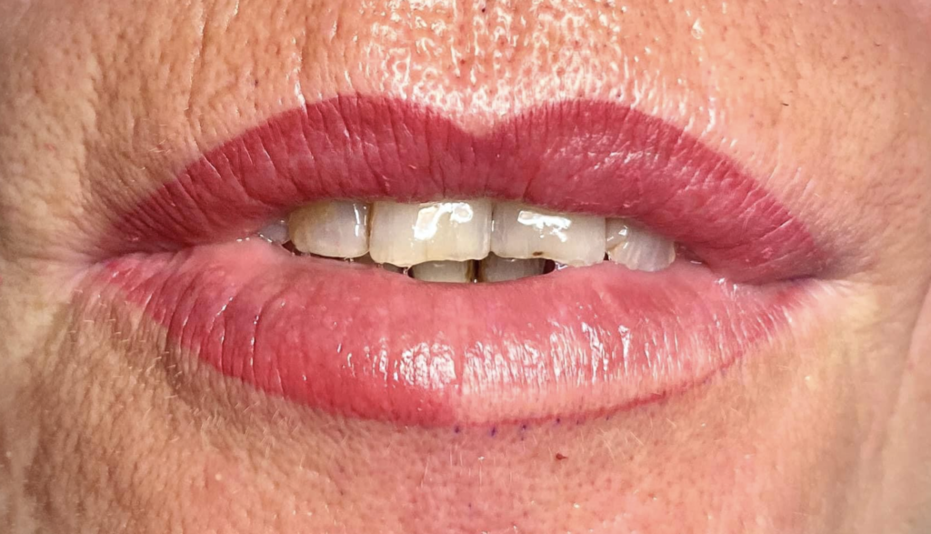 PMU Lippenpigmentierung mit natürlicher Kontur am Vermilionrand – leicht vergrößerte Lippen mit rosigem Farbverlauf